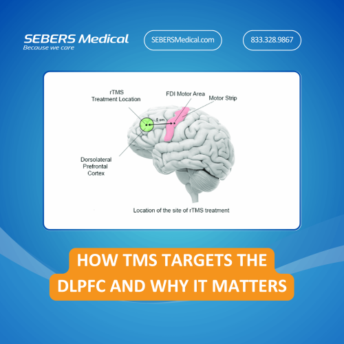 TMS zielt auf den DLPFC