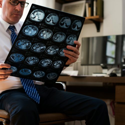 Why TMS Belongs in Every Mental Health Practice