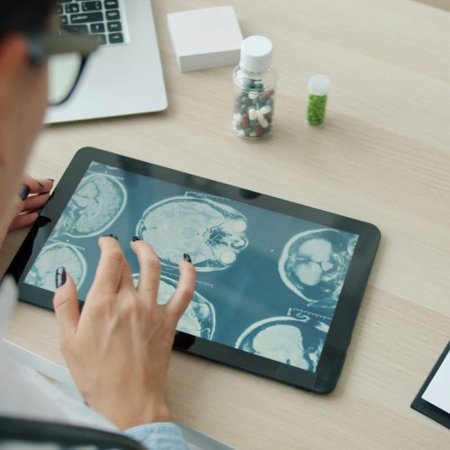 TMS workflow psychiatry clinic